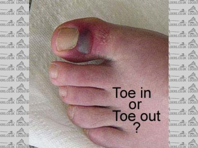 squashed toe